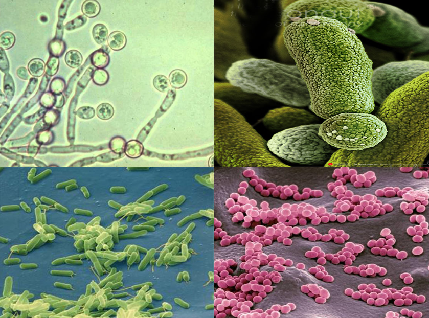 Vì Sao Bùn Vi Sinh Trong Hệ Thống Xử Lý Nước Thải Bị Chết Và Giải Pháp Khắc Phục